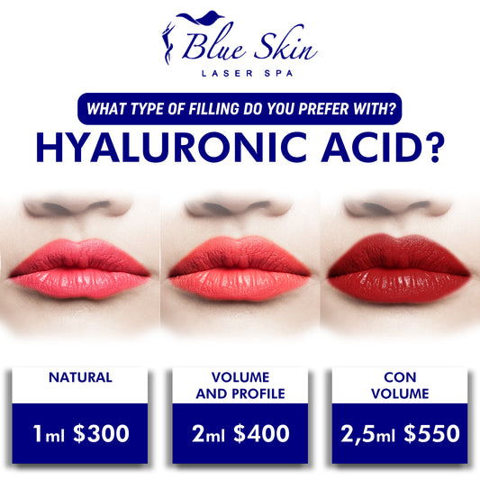 Fillers (Radiesse & Versa) (One Syringe)