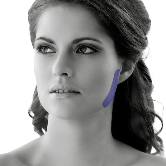 Sideburn Laser Hair Removal for Women