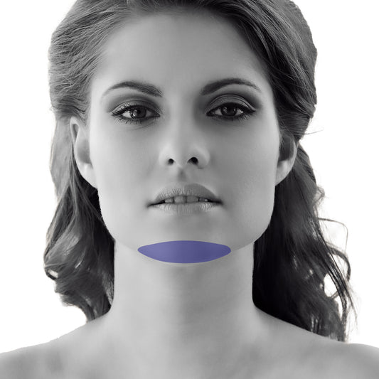 Chin Laser Hair Removal For Women