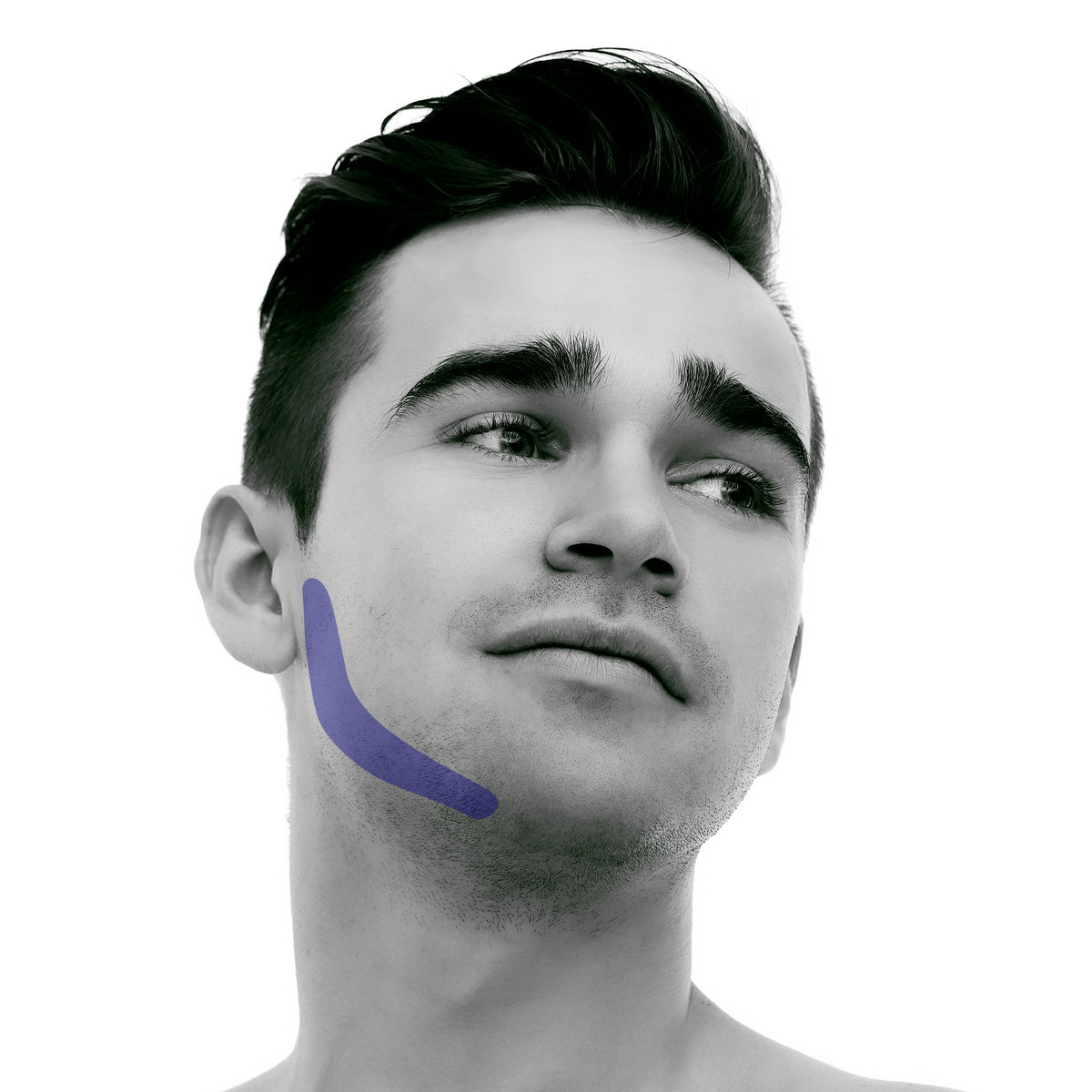 side-burn Laser Hair Removal for Men