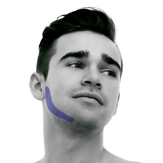 side-burn Laser Hair Removal for Men